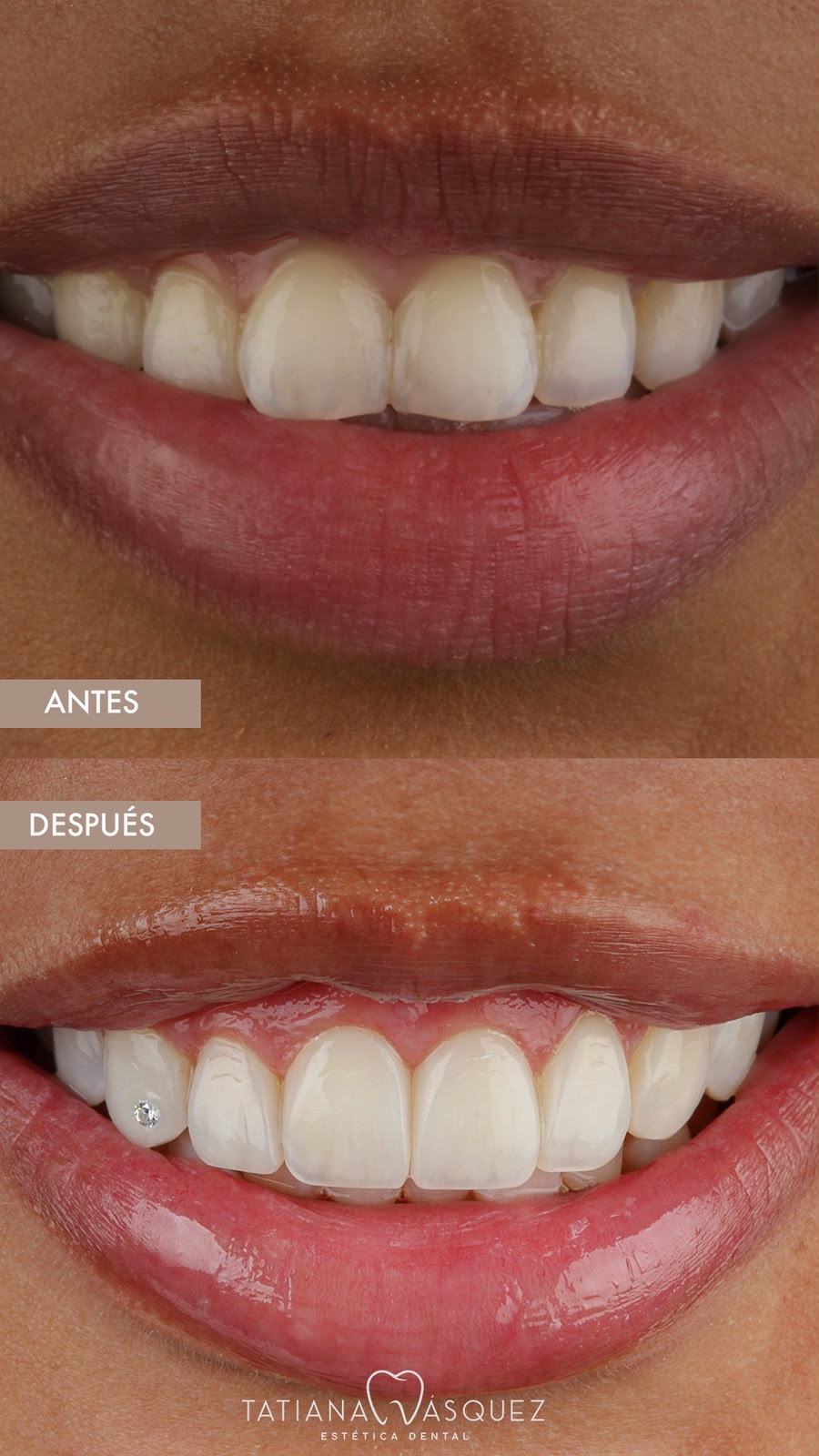 perfeccionamiento dental Medellín