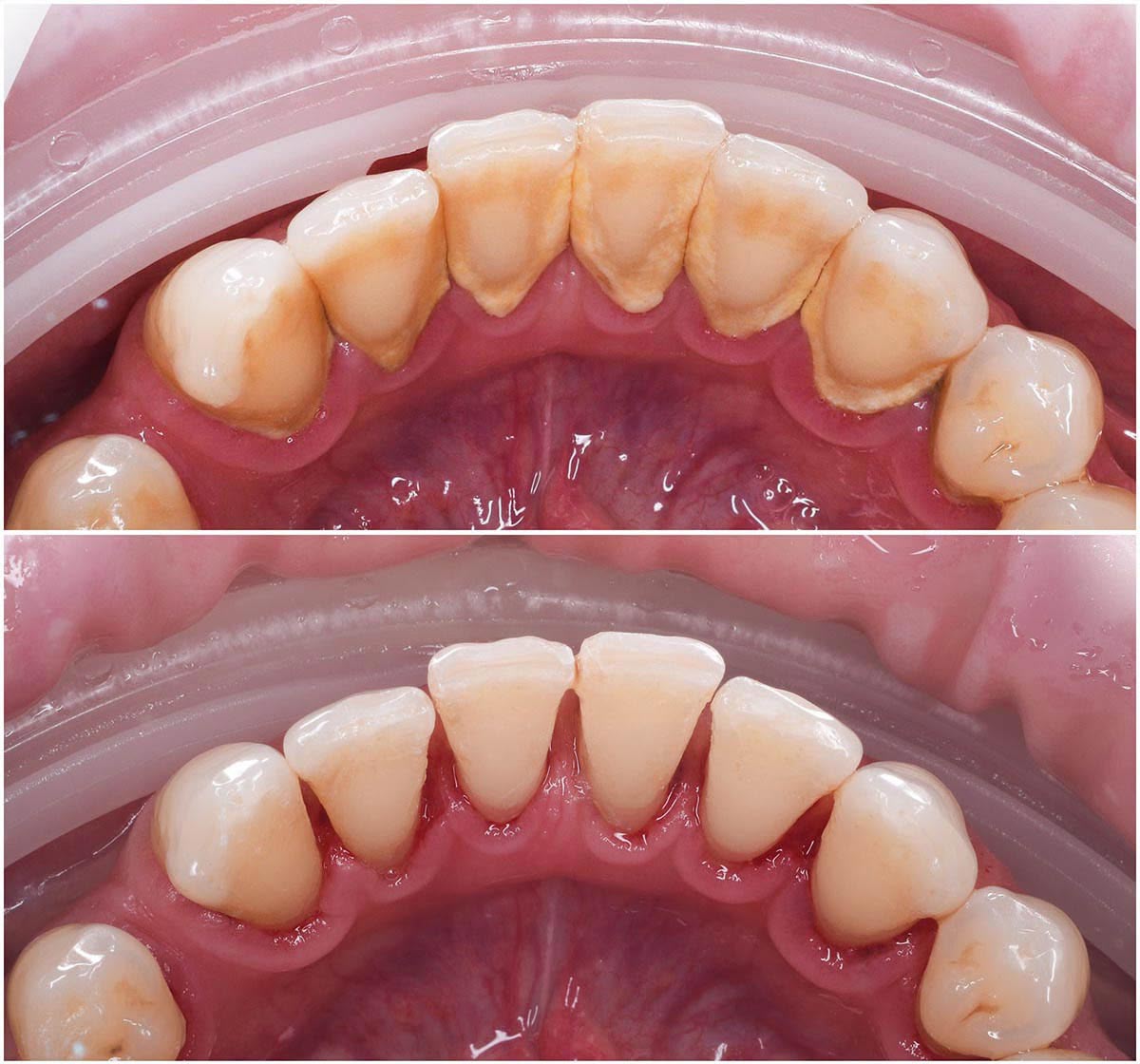 higiene oral profesional Medellín